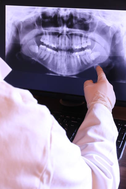 Best Emergency Broken Tooth Repair in St Anthony, ID