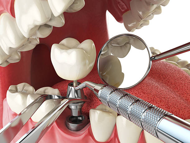 Best Emergency Dental Care for Trauma or Injury in St Anthony, ID
